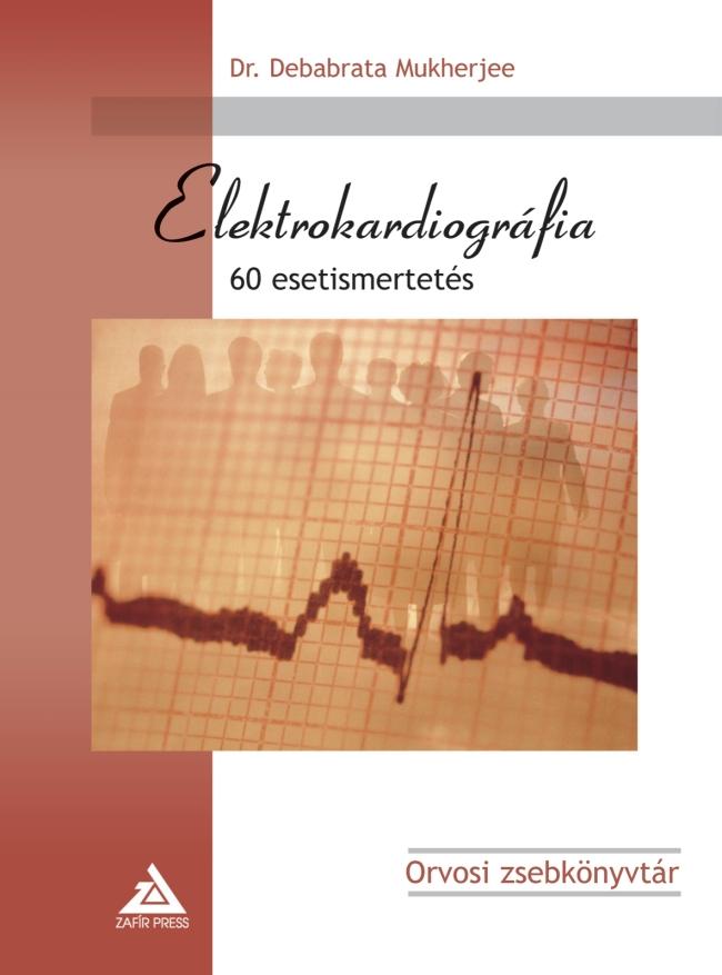 Debabrata Dr. Mukherjee - Elektrokardiogrfia - 60 Esetismertets