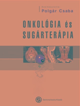 Polgr Csaba - Onkolgia s Sugrterpia